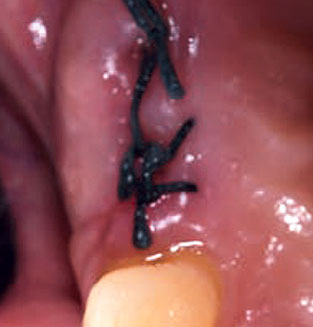 Slide T0