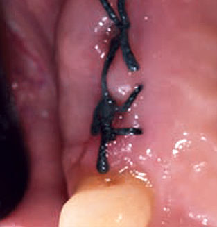 Slide T1